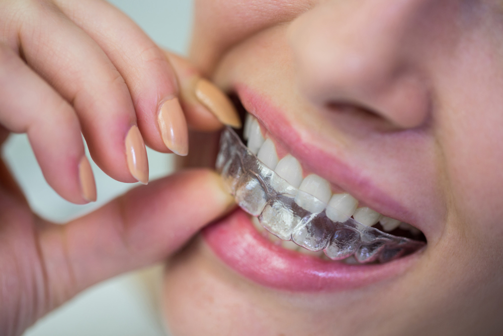 Tout savoir sur les soins dentaires en Espagne : types de traitements, prix, délais