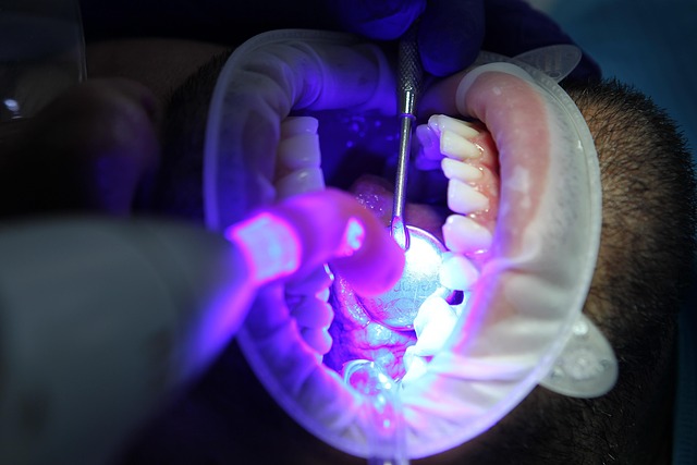 intervention dentiste